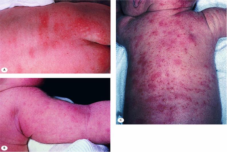 Clinical Guidelines (Nursing) Neonatal & infant skin care